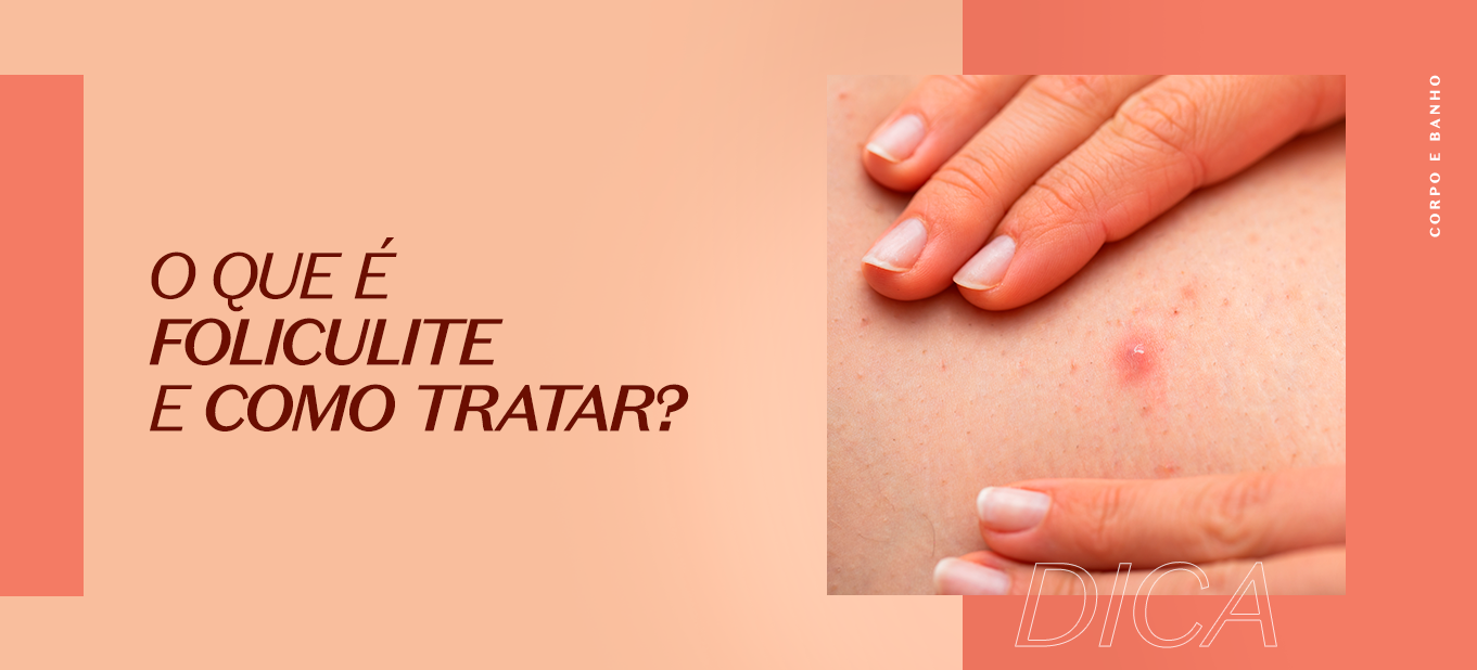 o que é foliculite e saiba como fazer o tratamento | O Boticário